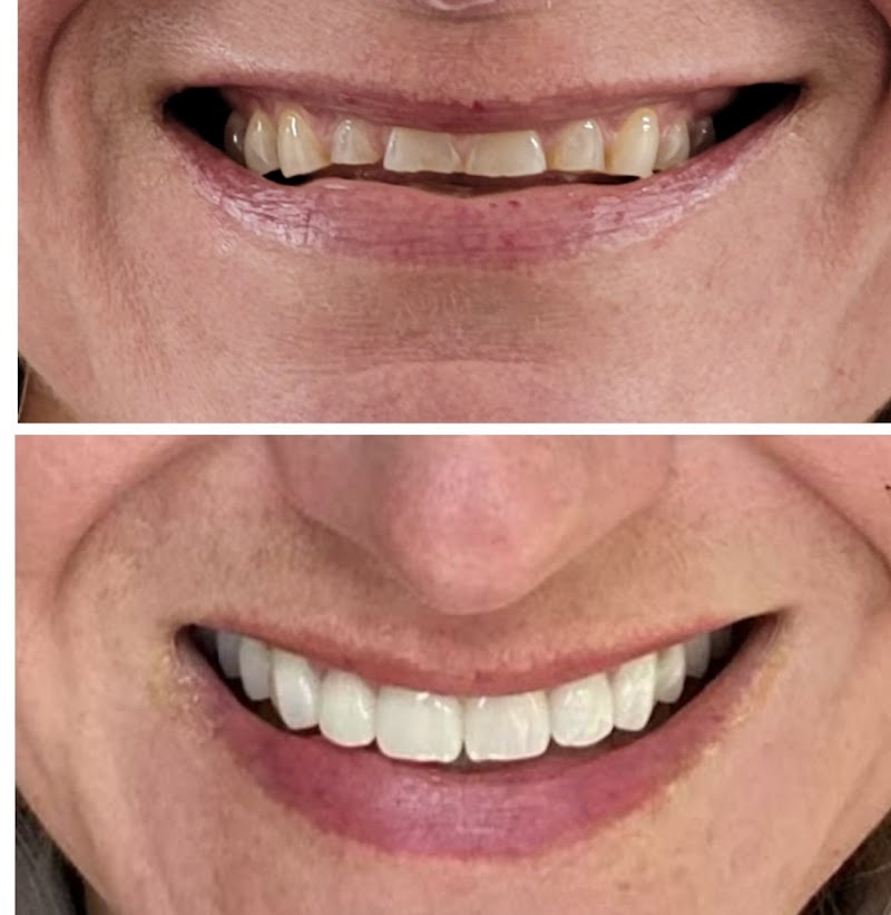 Love Your New Smile-Dr Peter Diacoloukas