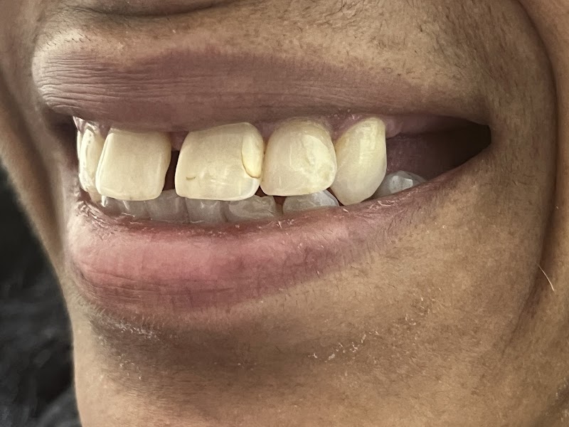 Love Your New Smile-Dr Peter Diacoloukas