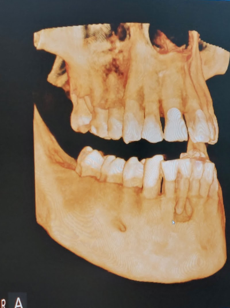 Love Your New Smile-Dr Peter Diacoloukas