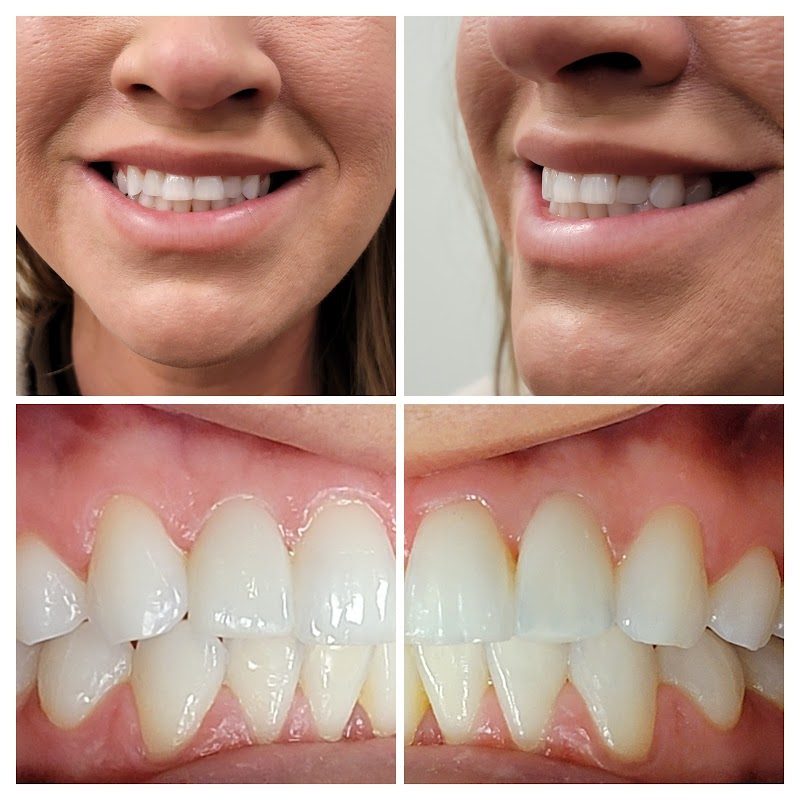 Love Your New Smile-Dr Peter Diacoloukas